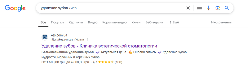mikrorazmetka-dlya-sayta.png