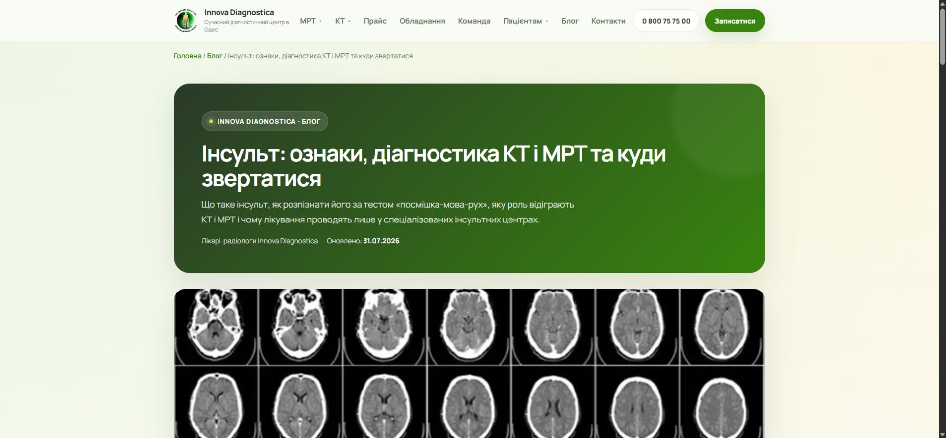 Статья о признаках инсульта и диагностике КТ и МРТ